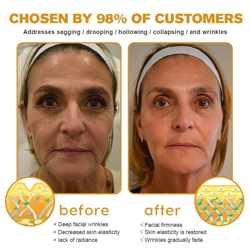 ✨ Smooth Wrinkles Without Botox – 49% OFF – 🌿 Bee Venom Wrinkle Removal Cream – Lift, Firm & Rejuvenate 💖