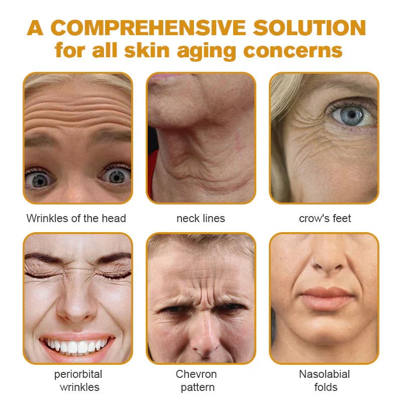 ✨ Smooth Wrinkles Without Botox – 49% OFF – 🌿 Bee Venom Wrinkle Removal Cream – Lift, Firm & Rejuvenate 💖